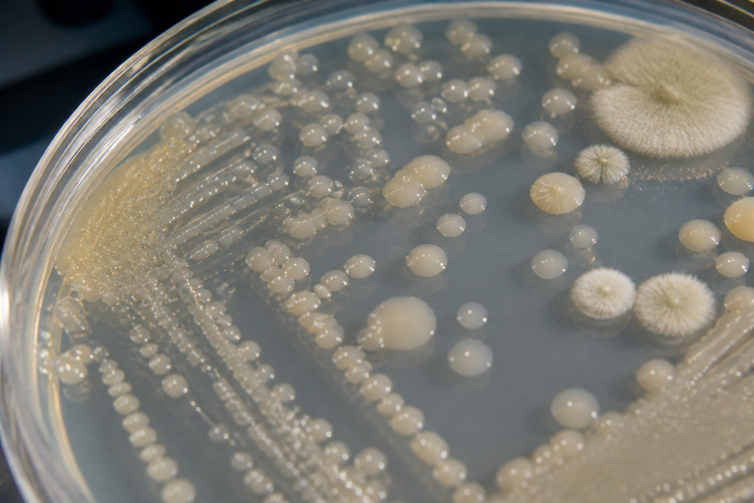 Cultures bactériennes observées en laboratoire